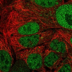 APOA1BP Antibody, Novus Biologicals 25 &mu;L | Buy Online | Novus Biologicals | Fisher Scientific